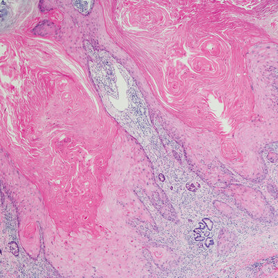 Dermatopathology