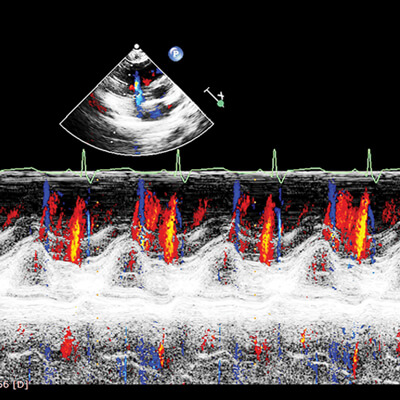 Echocardiography - A Comprehensive Review