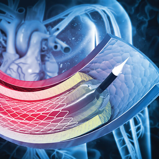 Oakstone CME Comprehensive Review and Update of What's New in Vascular and Endovascular Surgery