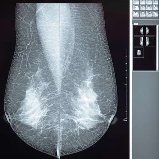 Oakstone CME Comprehensive Review of Breast Imaging