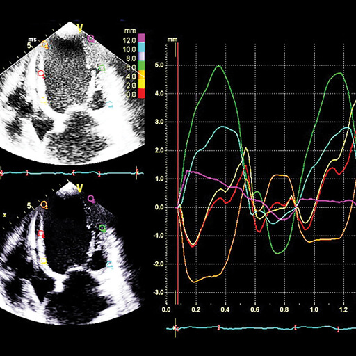 Oakstone CME Echocardiography - A Comprehensive Review
