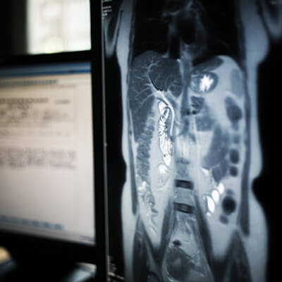 UCSF Abdominal & Pelvic Imaging