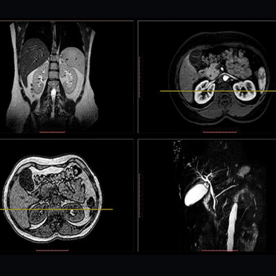 UCSF Abdominal and Thoracic Imaging
