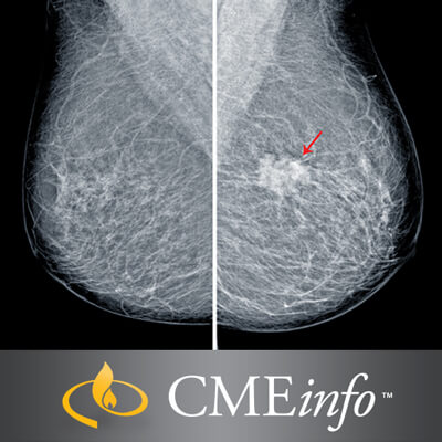 UCSF Breast Imaging