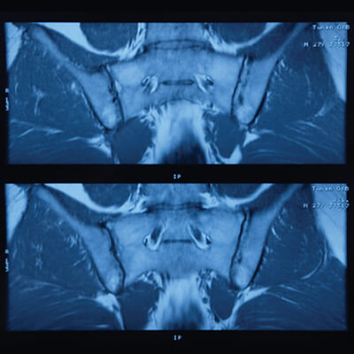 UCSF Musculoskeletal Imaging