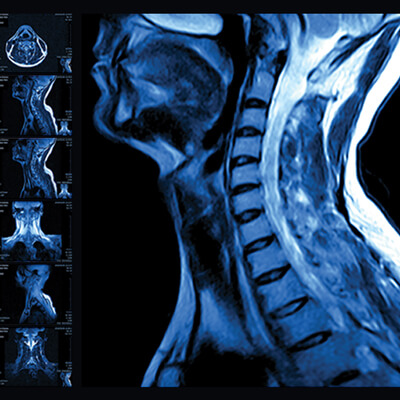 UCSF Neuro and Musculoskeletal Imaging