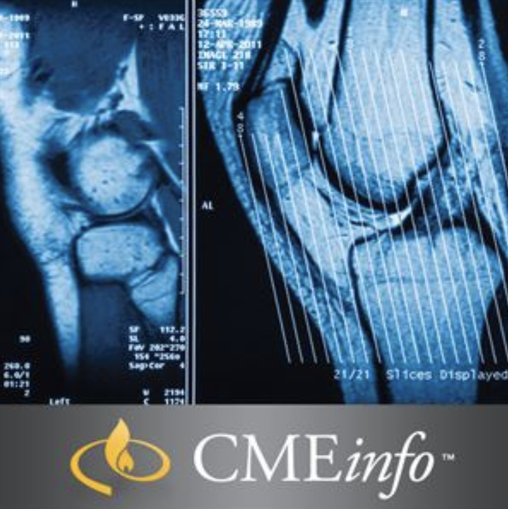 UCSF Musculoskeletal MRI: University of California San Francisco Clinical Update