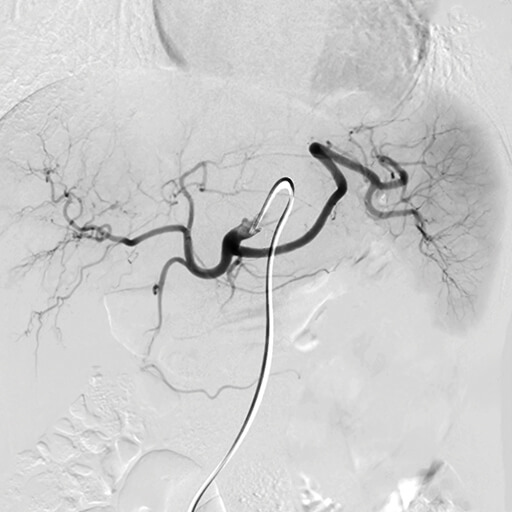 Oakstone CME NYU Langone Vascular and Interventional Radiology Review and Update