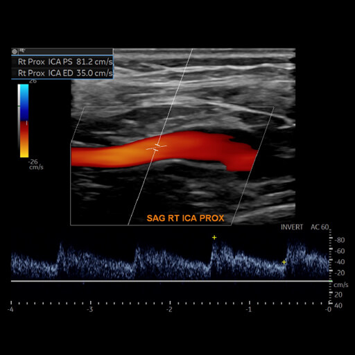 Oakstone CME Society for Vascular Medicine Comprehensive Review of Vascular Ultrasound Interpretation and Registry Preparation