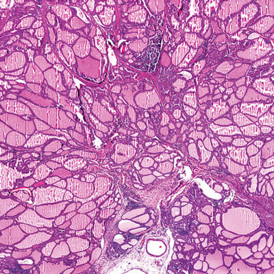 Head and Neck Pathology