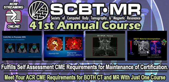 prostata mri cme