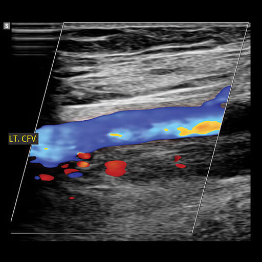 Oakstone CME Clinical Approach to Vascular Ultrasound and RPVI Prep Course