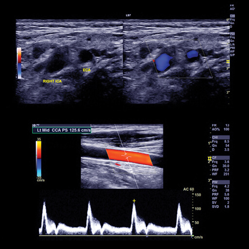 Oakstone Clinical Approach to Vascular Ultrasound and RPVI Prep Course