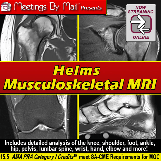 Meetings-By-Mail Helms Musculoskeletal MRI