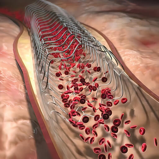 Oakstone CME Comprehensive Review of Interventional Cardiology