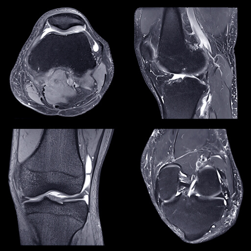 Oakstone CME NYU Langone Advanced Imaging of the Musculoskeletal System: Up Your Game