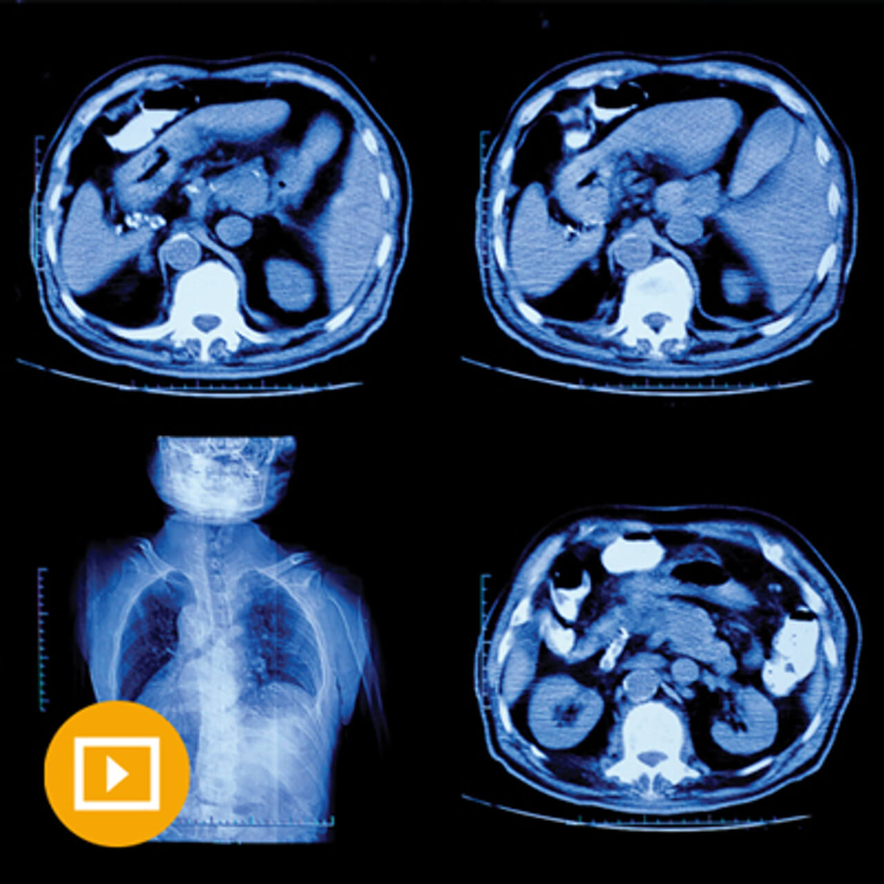 Oakstone CME UCSF Abdominal and Thoracic Imaging