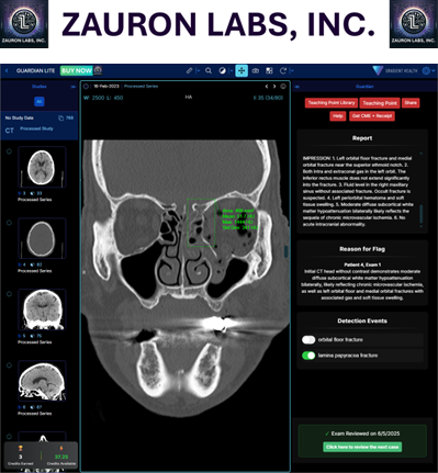 Zauron Radiology
