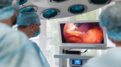 Adult Gastrointestinal Polyp Classification and Management