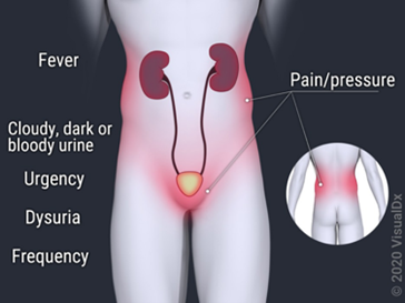 Family Medicine Sample CME Question 2