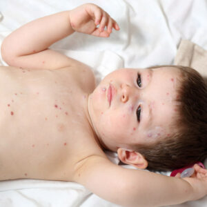 ImageSim Pediatric Dermatology - Identify and Diagnose Concerning Presentations