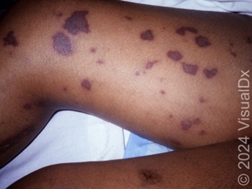 Emergency Medicine Sample CME Question 1