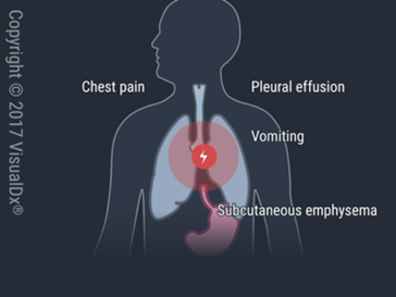 Emergency Medicine Sample CME Question 2