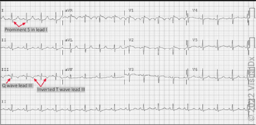 Emergency Medicine Sample CME Question 3
