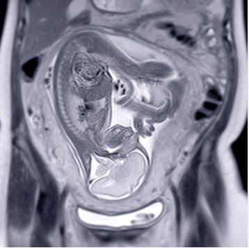 Oakstone CME UCSF OBGYN Women’s Imaging
