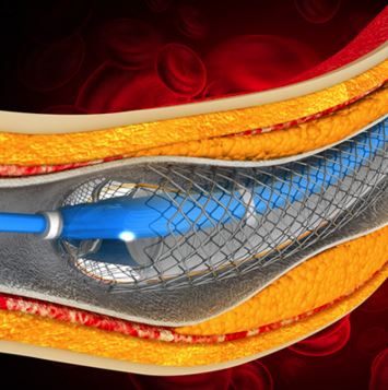 Oakstone CME Comprehensive Review and Update of What’s New in Vascular and Endovascular Surgery