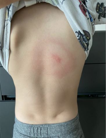 Pediatric Imaging Sample CME Question 2