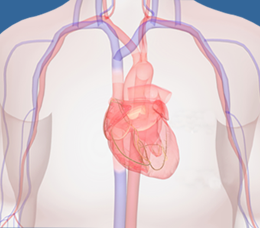 Med-IQ CME: oHCM: Changing the Paradigm for Clinicians and Keeping Patients Informed