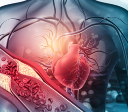 Med-IQ CME: LDL-C Management in High-Risk ASCVD: Current Treatment Options and the Evolving Role of PCSK9 Inhibitors